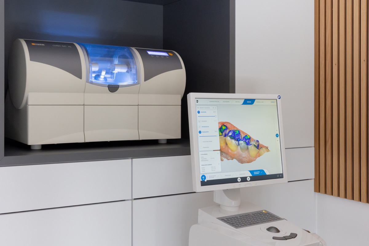 CEREC-Arbeitsplatz mit digitaler dreidimensionaler Zahndarstellung